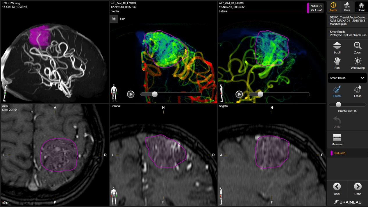Software Solution for Cranial Vascular Planning | Brainlab